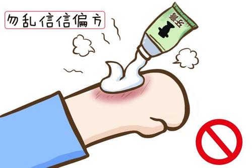 被烧了