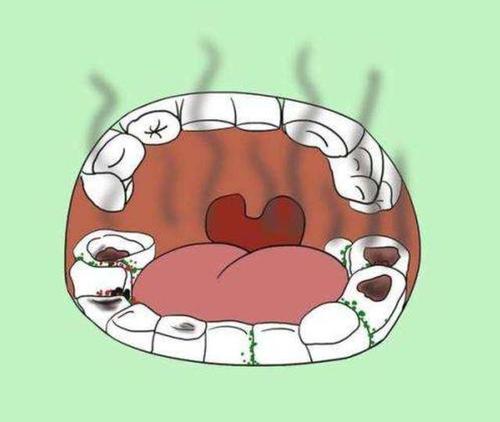 口中争执