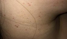 橘点点和红点点