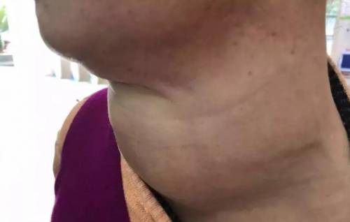 都是枪声造成的