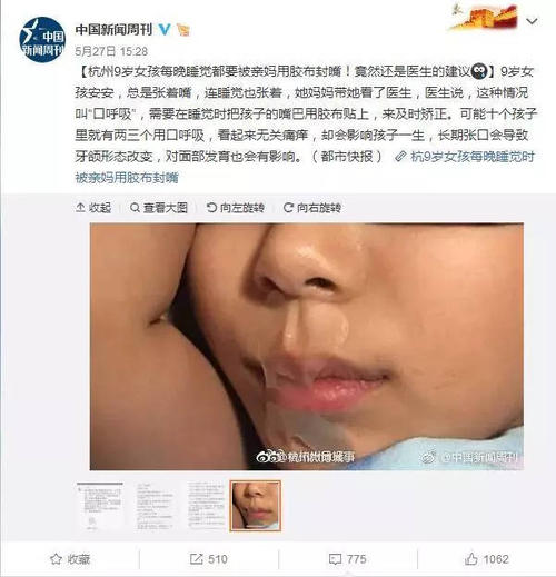 妈妈的嘴