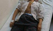 奶奶的手受伤了