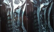 进化？还是退变？