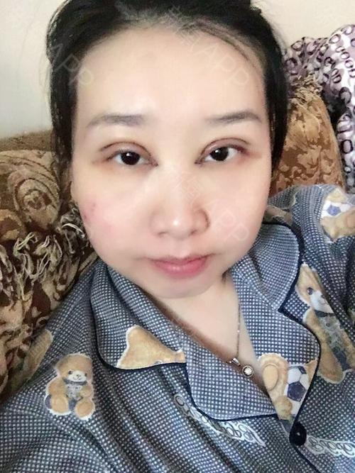 痛苦也很漂亮