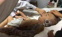 病房里的小妹妹