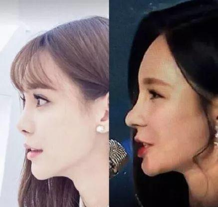 那个脸