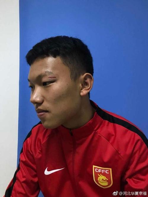 裂眼皮
