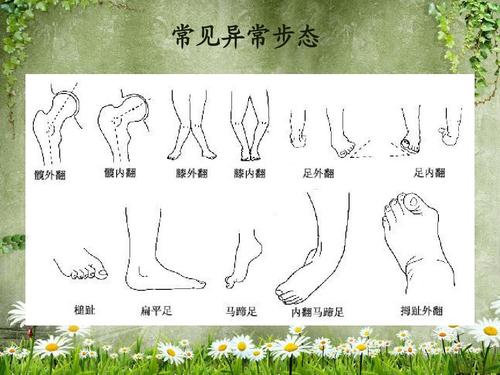 摆动步态