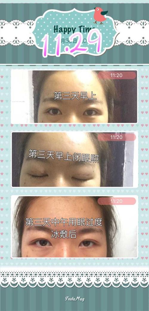 应该记住