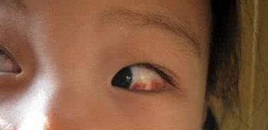妈妈的眼睛