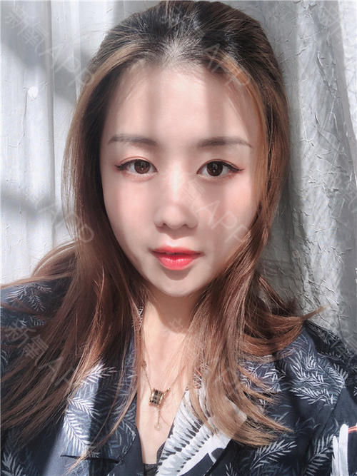 美丽的错