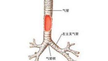 可怕的支气管炎