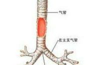 可怕的支气管炎