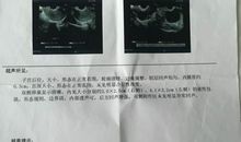 这究竟是为什么？