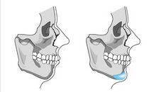 共享物品究竟为我们带来了什么？