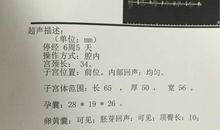 不要等到第二天