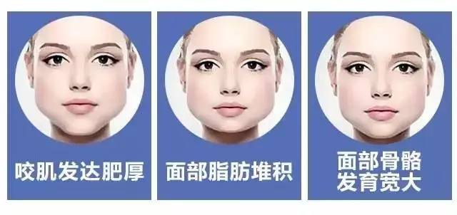 担心疫苗
