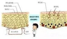 保护有时是一种伤害