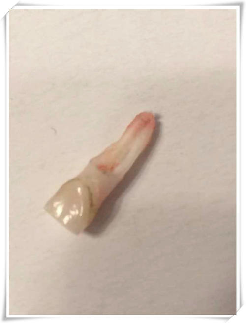 小白兔拉