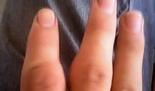 你的手是不是很疼