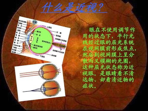 近视伤害