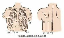 我终于懂得了老师的用心