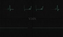 心，一直在跳动