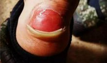 有一种美丽叫伤痕