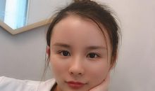 额头上书写的爱