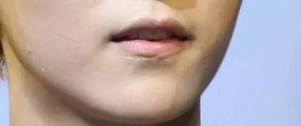 在伤疤中的爱