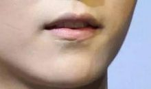 藏在疤痕里的爱