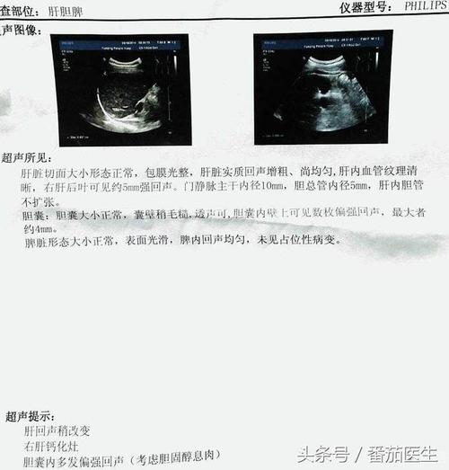 Echo给了我启示