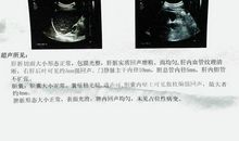 回声给我的启示