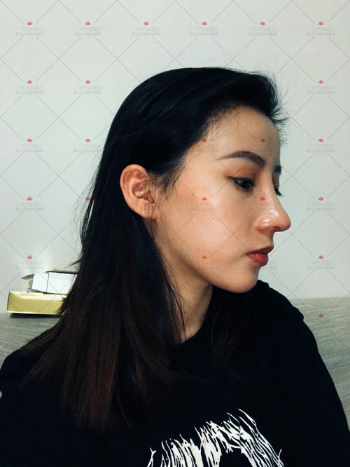 我是特别的朋友