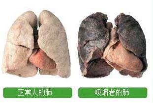吸烟对青少年有害