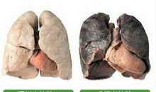 吸烟对青少年的危害