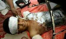 可怜的战争儿童_350字