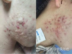 疤痕视图_550字