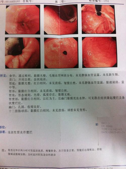 2015天津高级考试成分分析：取出我的______