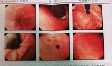 2015年天津中考作文解析：晒出我的______