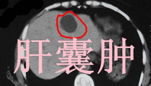 无人