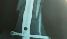 卷十六·三长月