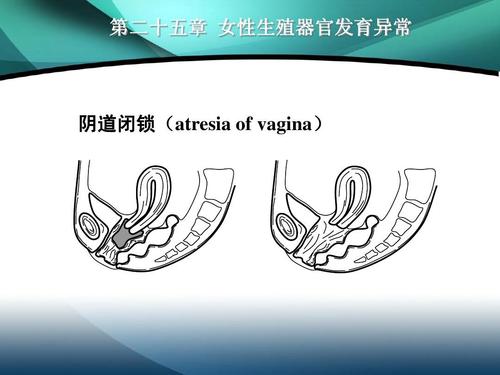 
古老的波塞顿说，预言已经偷偷了进入大海。巴黎听到了这一预测，他的心是非常恐惧的。过了一会儿，大海被炸毁在海里。海伦躺在他的怀抱中，他立刻忘了这个遗忘了。后来，战争来到克兰娜，他们降落在岛上。 Yenerhara Oys，妻子，志愿者，志愿者，婚姻的妻子。他们抱着一个盛大的婚礼，沉浸在婚礼的幸福中，两个人忘记了家人和祖国。他们依靠珍宝带来的珍品，豪华的豪华住在岛上。在过去的几年里，他们乘坐回到特洛伊。
