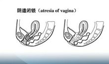 第二十五章-劫走海伦