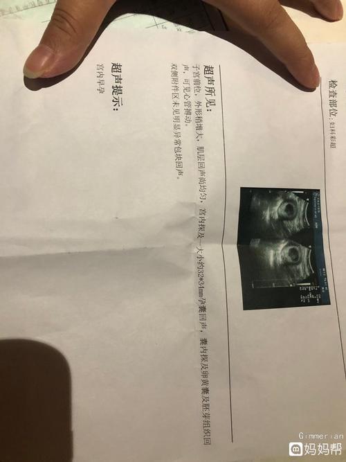 第一次血液测试_350字