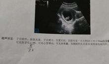 比伟大更伟大的妈妈_1200字