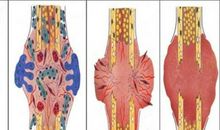 愈合的伤口或许还是伤口吧_1200字