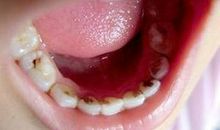 啊，我的牙齿_650字