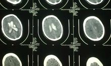 简单与复杂_800字