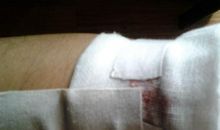 伤口再丑陋总有结痂的时候。_1500字